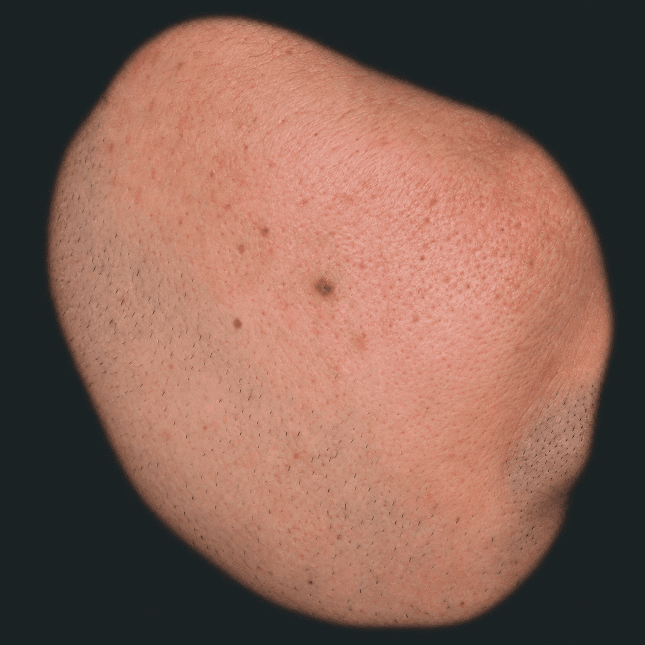 Detalle de la mejilla del mismo hombre, con pecas, poros y barba incipiente
